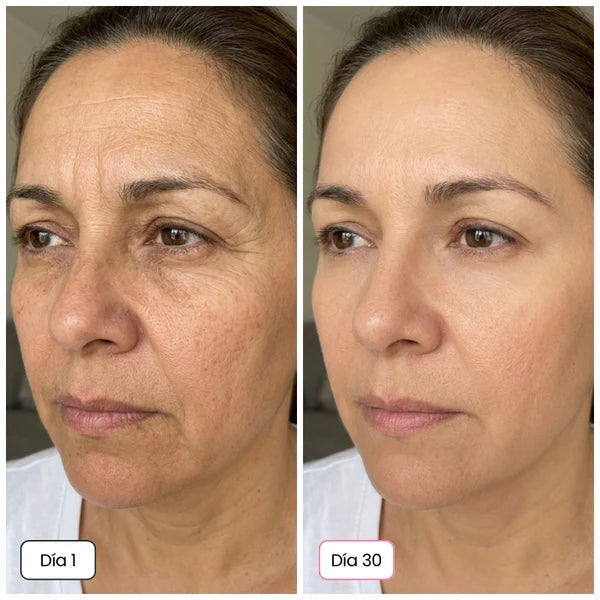 <h2>+4.000 Clientas Ya Aman el CollagenLift</h2>