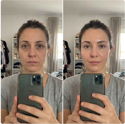 CollagenLift. Rejuvenece tu piel en solo 20 minutos