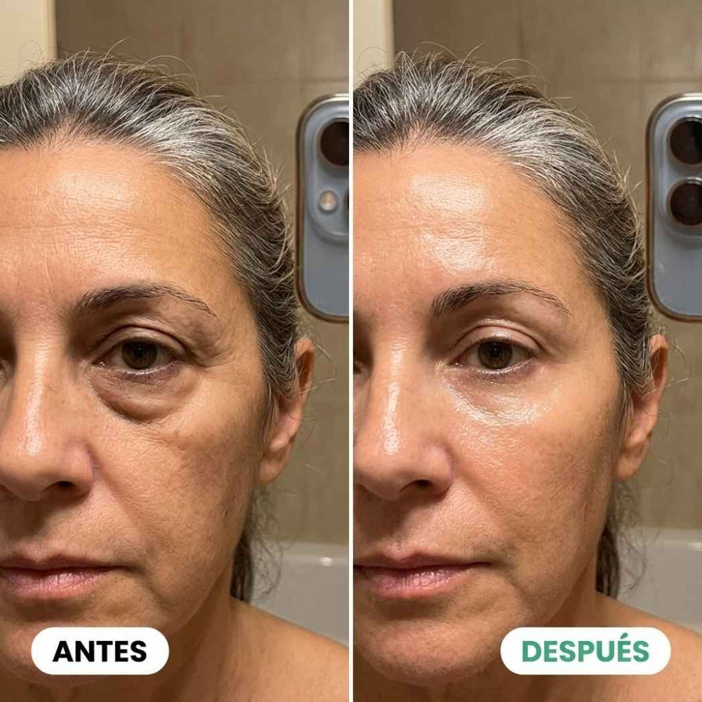 <h2>+3.000 Clientas Ya Aman el GlowPatch Eye</h2>
