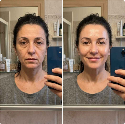 CollagenLift. Rejuvenece tu piel en solo 20 minutos